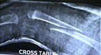 The Real A&amp;E: Episode 30 (season 1, episode 30)